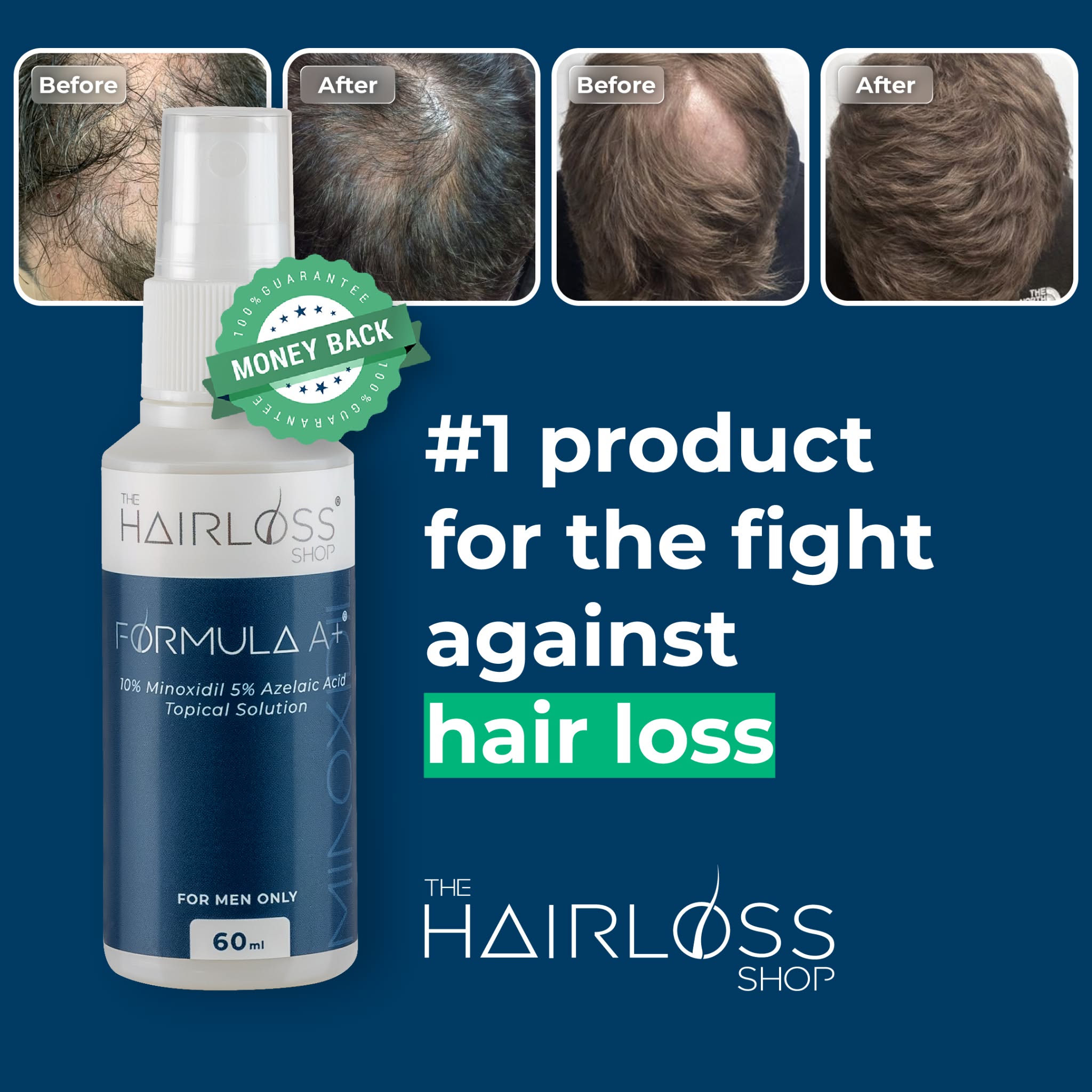 Collection of Men's Hair Loss Treatment - Formula A+ in a gallery layout