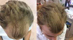 Collection of Men's Supercharged Hair Loss Treatment in a gallery layout