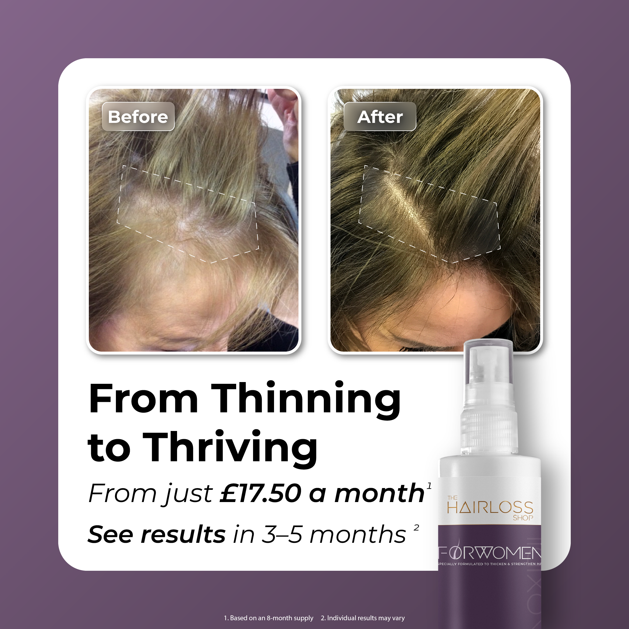 Collection of 'FORWOMEN' - Women's Hair Loss Treatment in a gallery layout