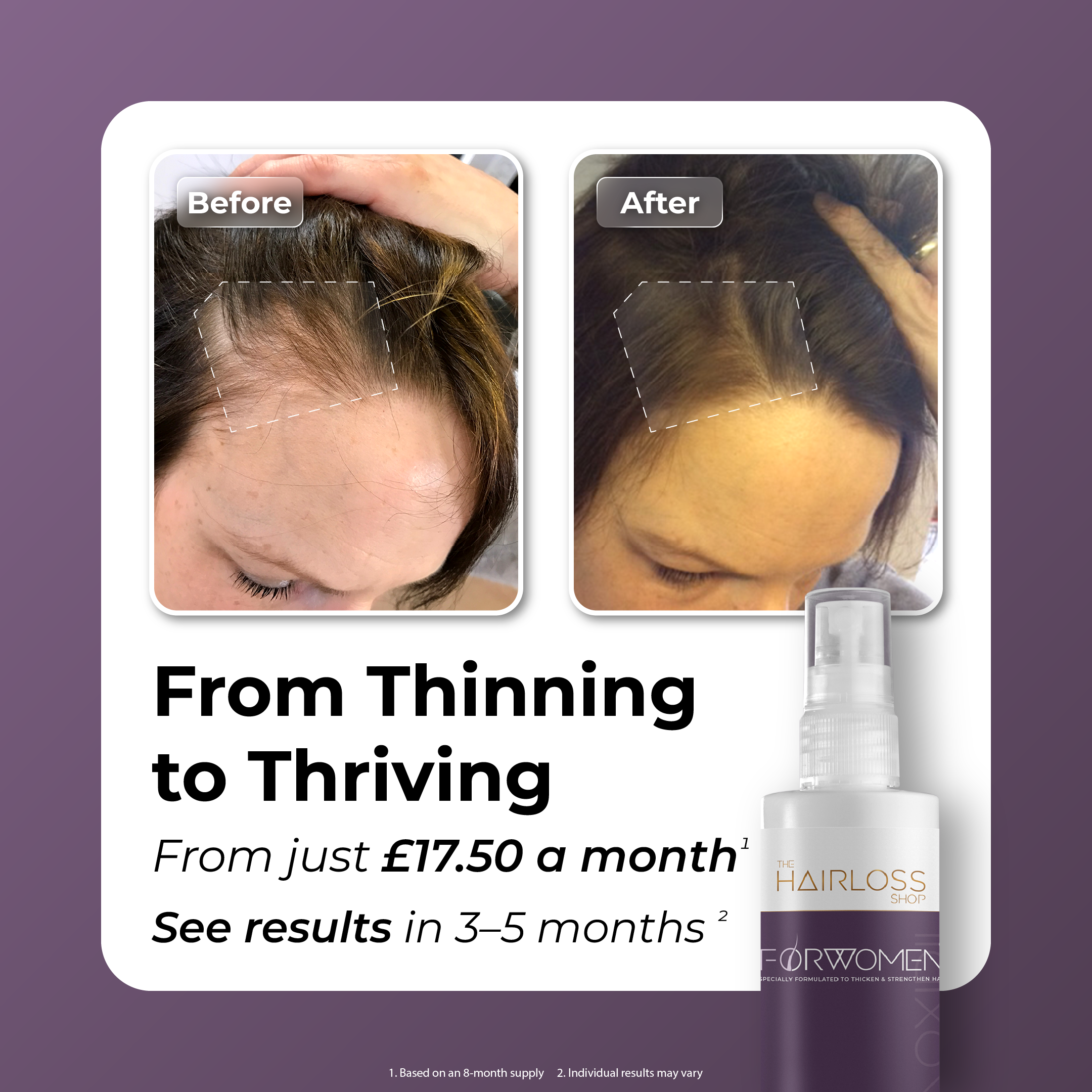 Collection of 'FORWOMEN' - Women's Hair Loss Treatment in a gallery layout