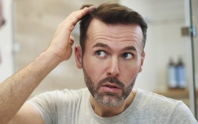 Exploring the Top Causes of Hair Loss